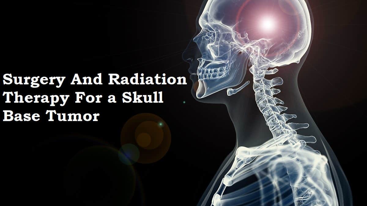 Surgery And Radiation Therapy For a Skull Base Tumor