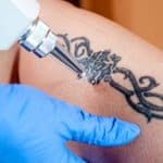 Would you like to remove your tattoo? 4 techniques that help