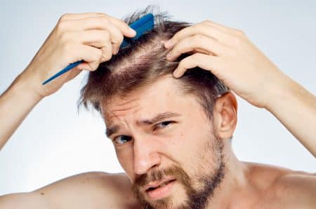 5 Early Signs of Balding You Can't Ignore