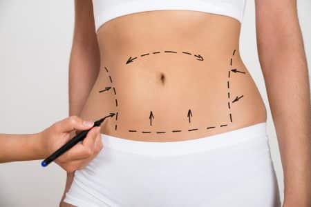 Cosmetic Surgery: What to Ask Your Surgeon Before Getting Implants