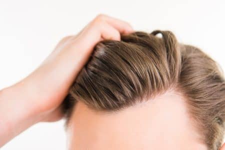 How Does Hair Restoration Work?