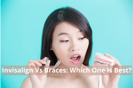 Invisalign Versus Braces: Which One Is Best?