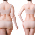 Ultimate Guide to Body Lift Surgery